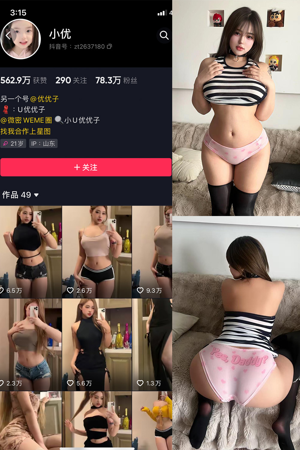 抖音 小U优优子 VIP 微密圈 NO.061期 【20P1V】最新至：2025.4.25-咪咪大车灯