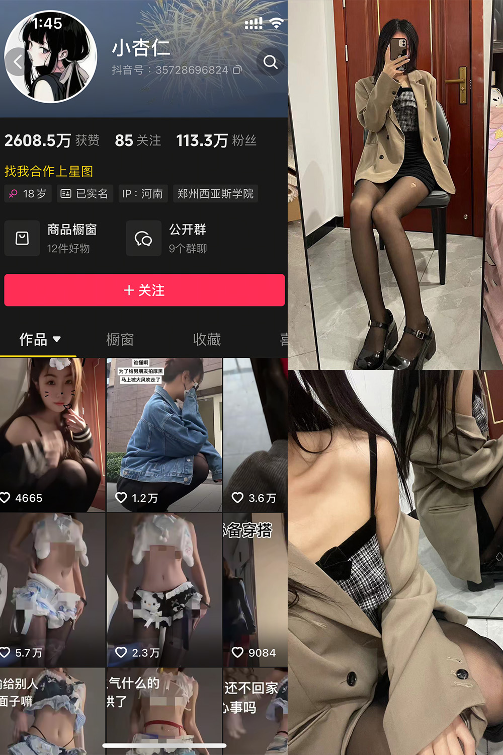 抖音 小杏仁 微密圈  NO.007 【61P】最新至：2025.3.10-咪咪大车灯