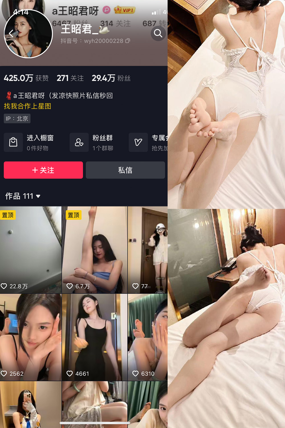 抖音 王昭君 微密圈  NO.023期 【29P6V】最新至：2024.6.6-咪咪大车灯