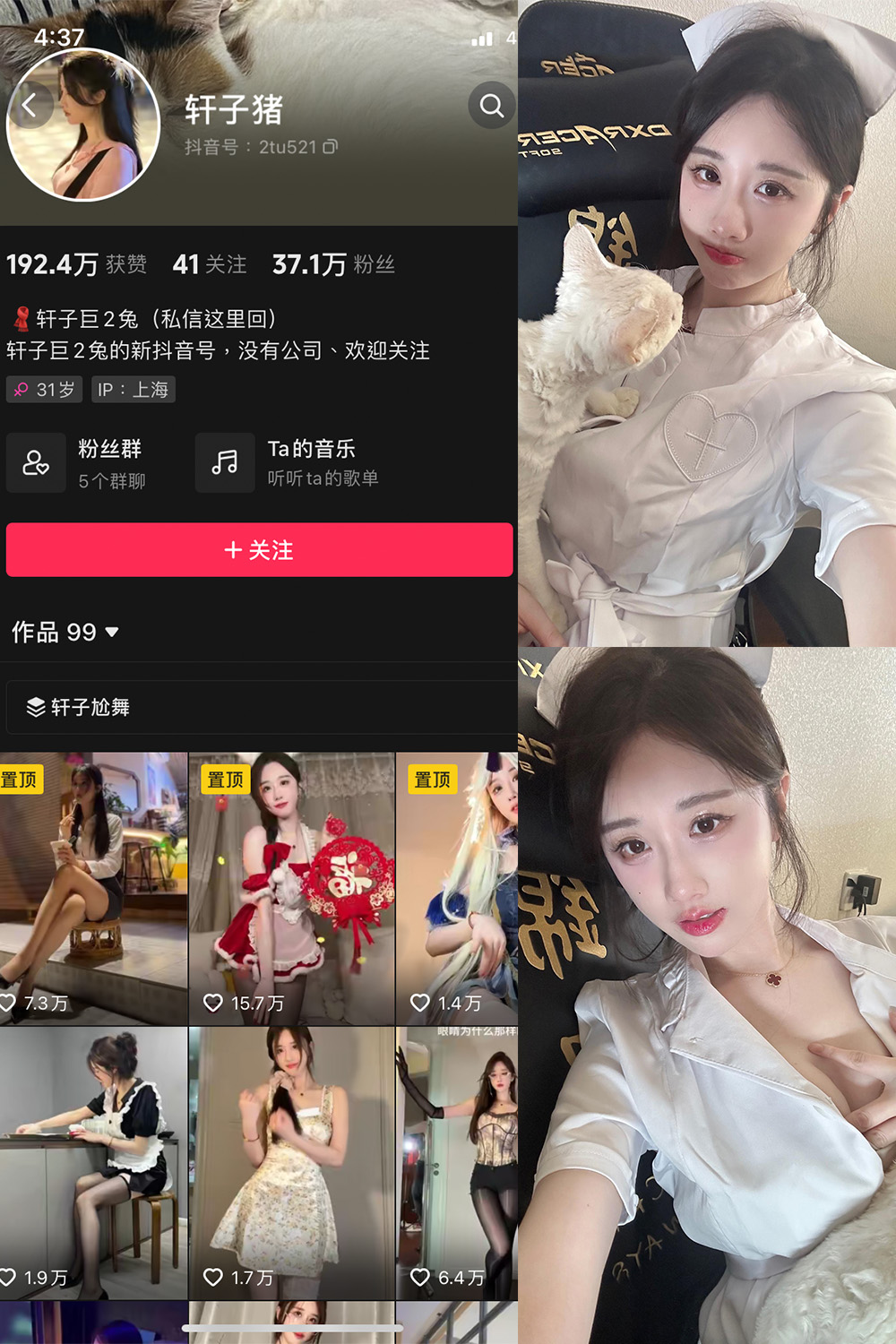抖音 轩子巨二兔 微密圈  NO.023期 【8P1V】最新至：2024.3.15-咪咪大车灯