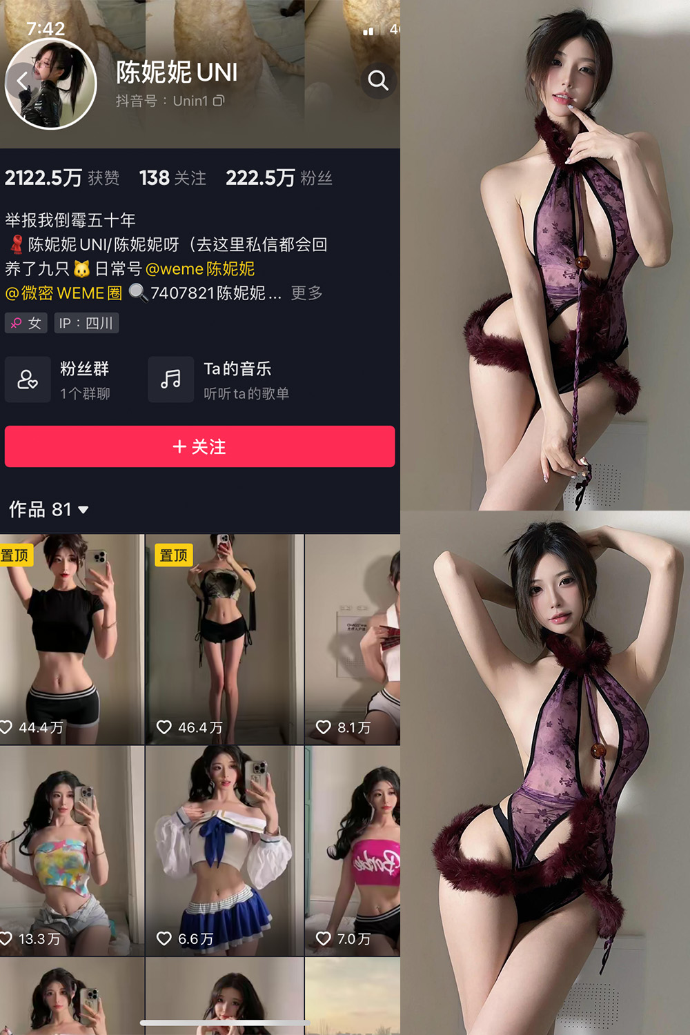 抖音 陈妮腻UNI 微密圈  NO.075期 【37P】最新至：2024.1.10-咪咪大车灯