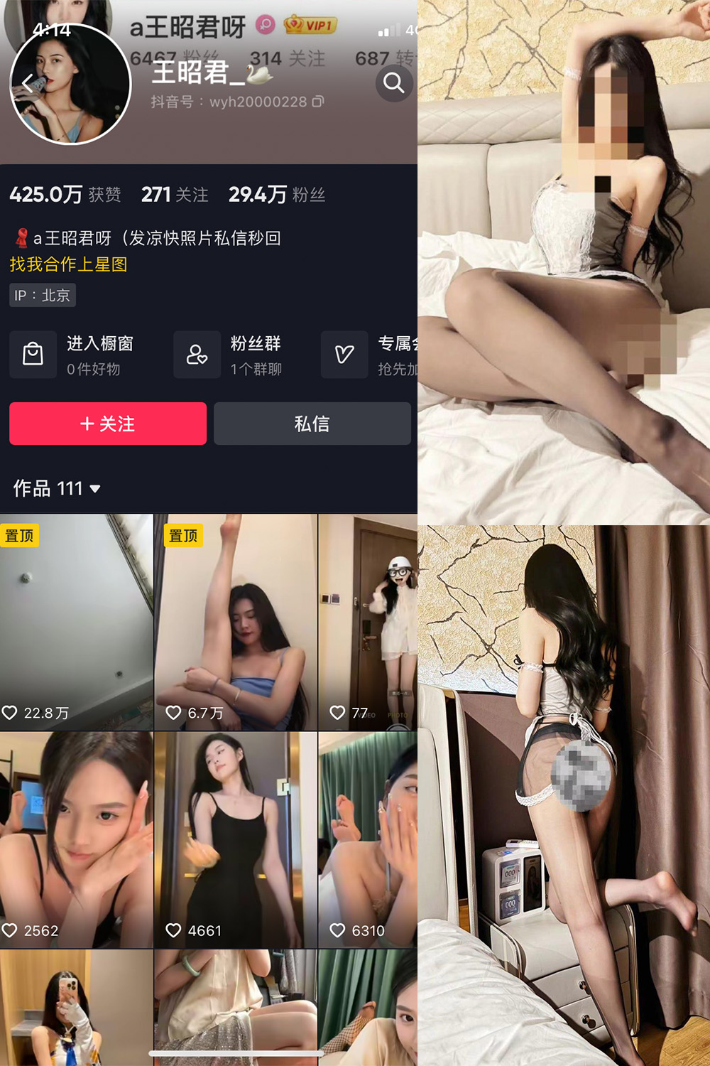 抖音 王昭君 微密圈  NO.020期 【8P2V】最新至：2023.12.04-咪咪大车灯
