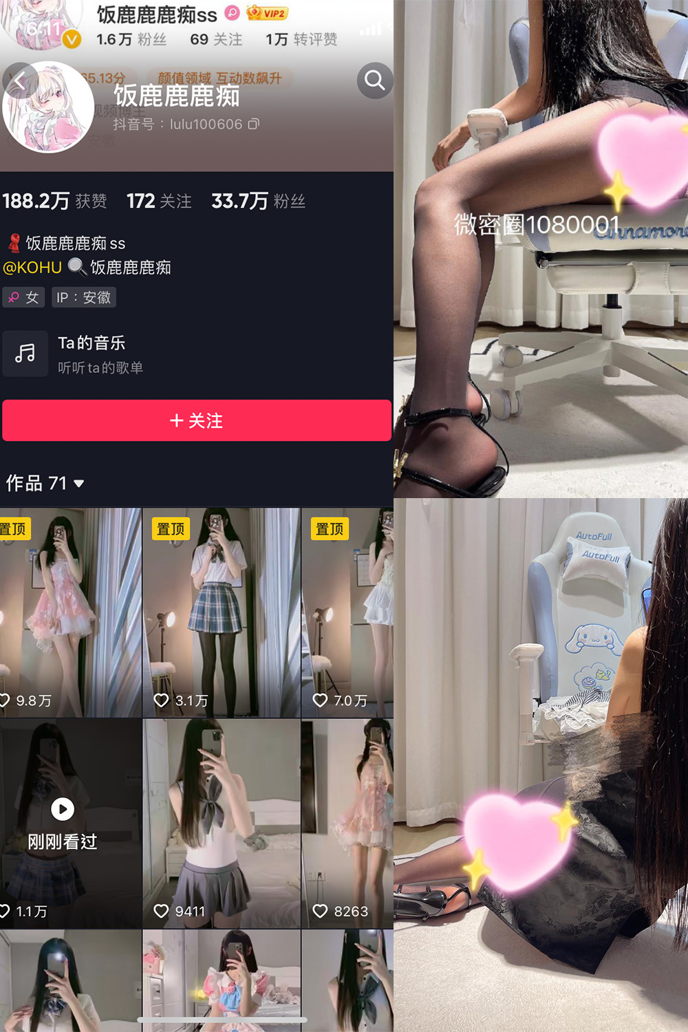 抖音 饭鹿鹿痴 微密圈  NO.018期 【9P1V】最新至：2023.12.02-咪咪大车灯