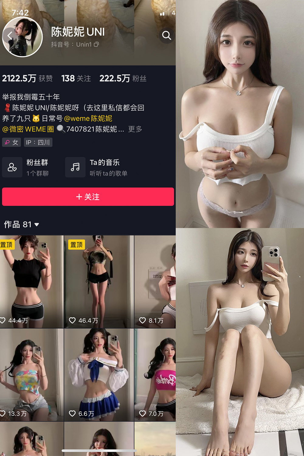 抖音 陈妮腻UNI 微密圈  NO.063期 【24P1V】-咪咪大车灯