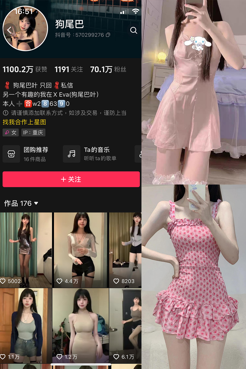 抖音 狗尾巴 微密圈  NO.004期 【25P5V】-咪咪大车灯
