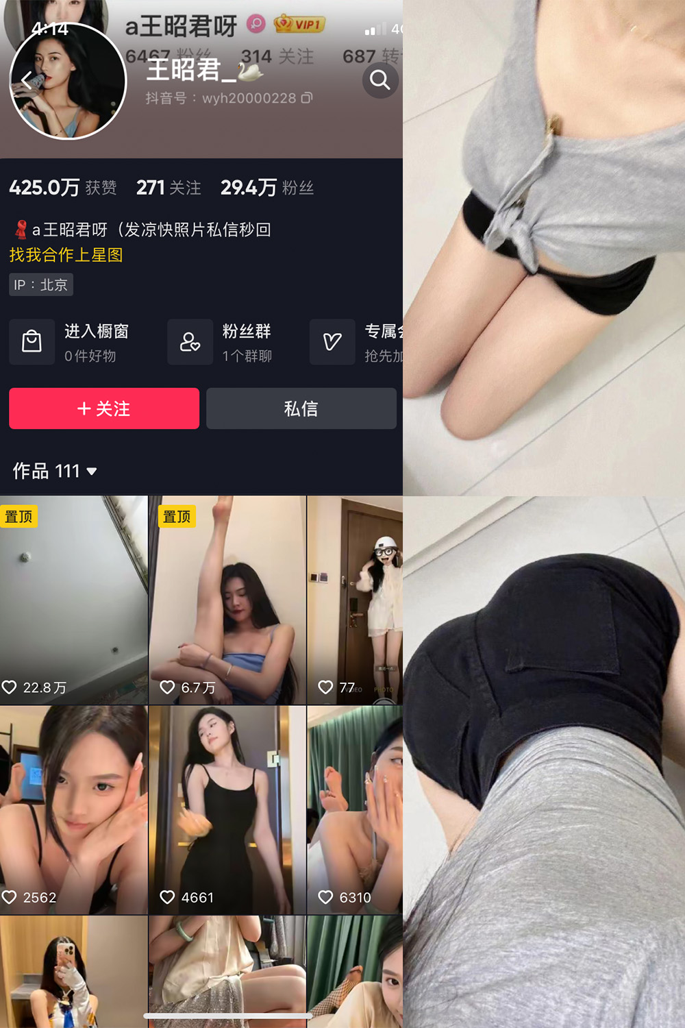 抖音 王昭君 微密圈  NO.017期 【23P】最新至：2023.10.26-咪咪大车灯