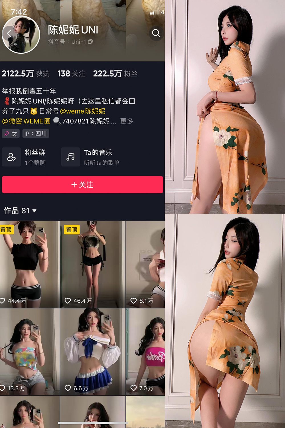 抖音 陈妮腻UNI 微密圈  NO.061期 【11P】-咪咪大车灯
