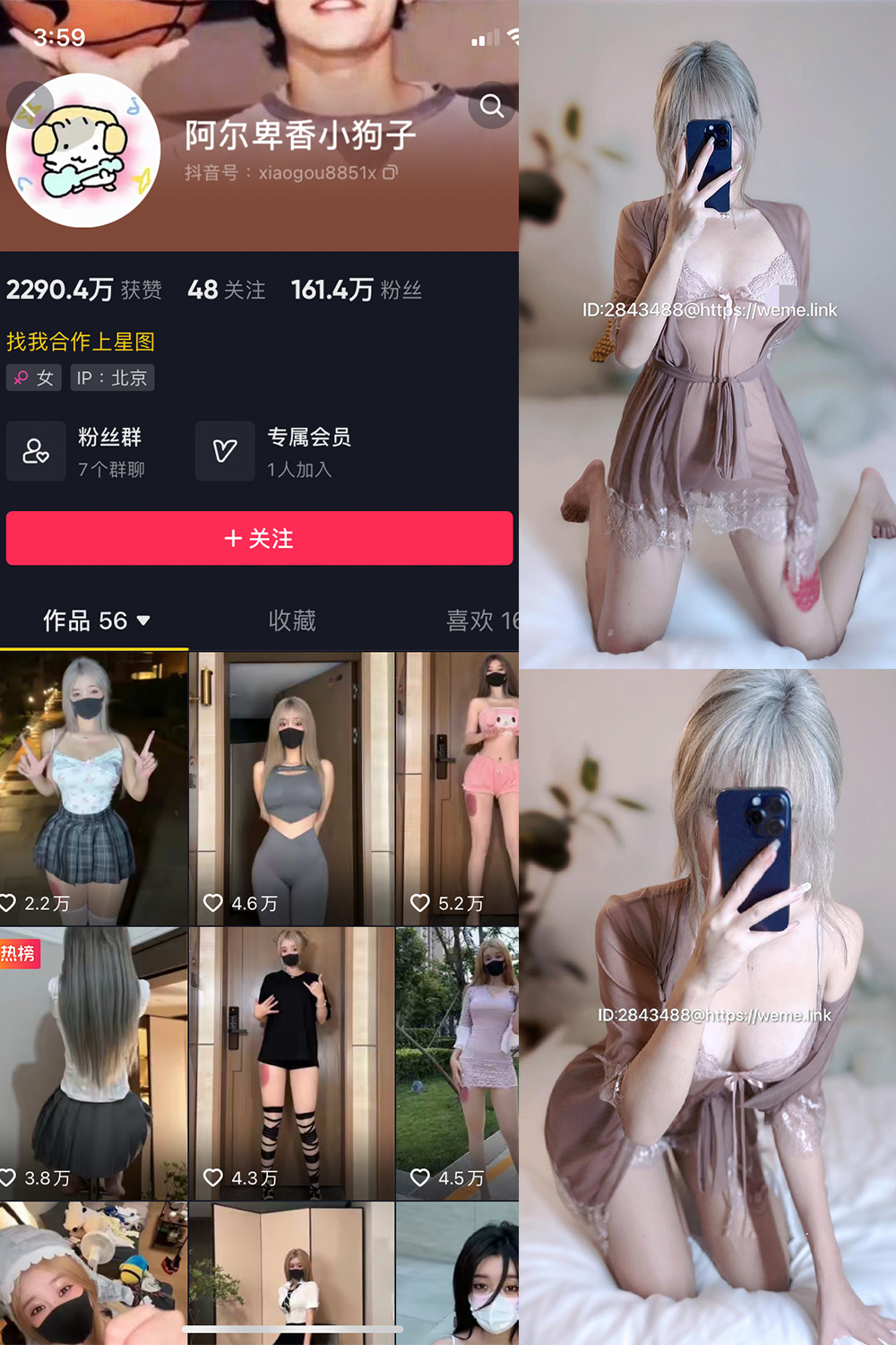 抖音 阿尔卑香小狗子 微密圈  NO.016期 【33P】-咪咪大车灯