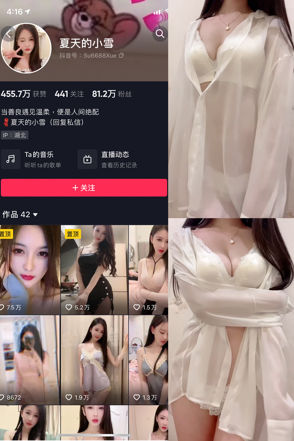 抖音 夏天的小雪 微密圈 嘉宾专享 NO.011期 【4P2V】最新至：2023.8.11-咪咪大车灯