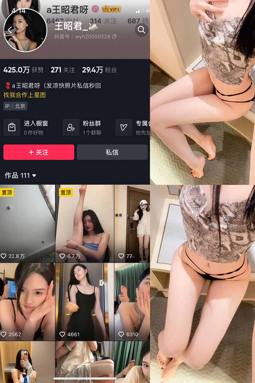 抖音 王昭君 微密圈  NO.015期 【13P】最新至：2023.8.5-咪咪大车灯