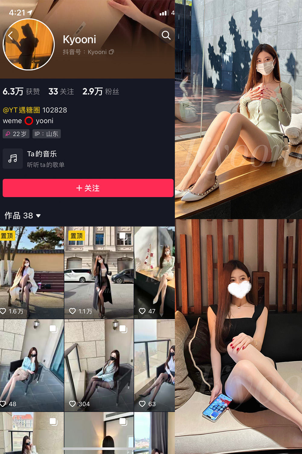 抖音 Yooni有你喵 微密圈  NO.006期 【78P3V】-咪咪大车灯