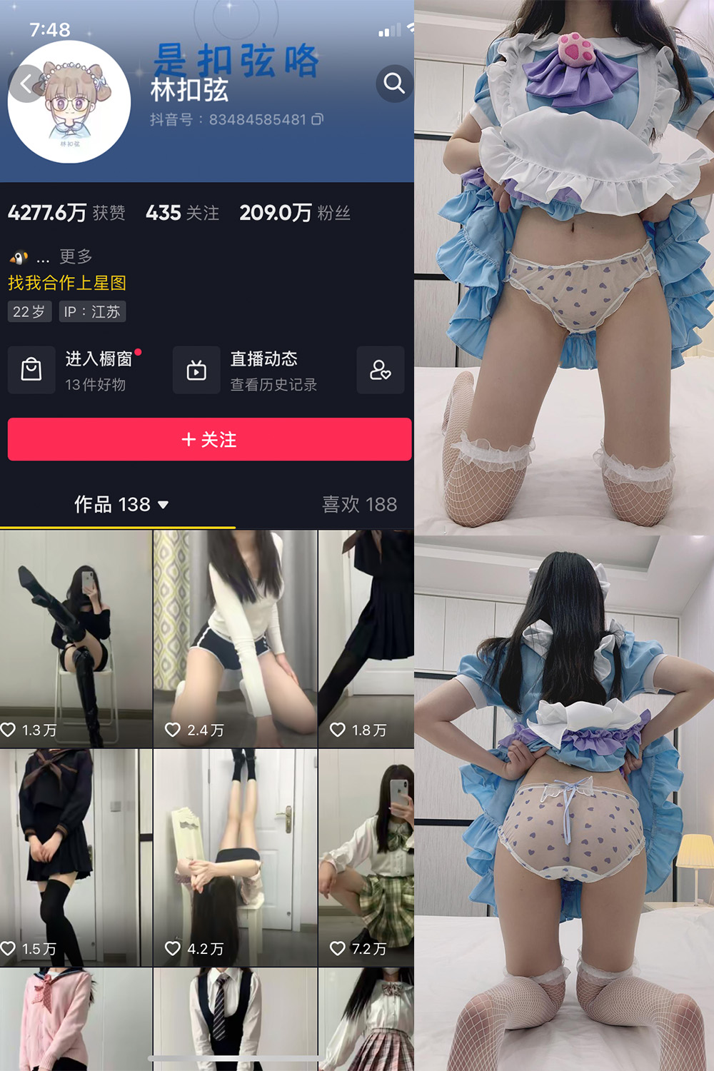 抖音 林扣弦 微密圈  NO.026期 【17P】-咪咪大车灯