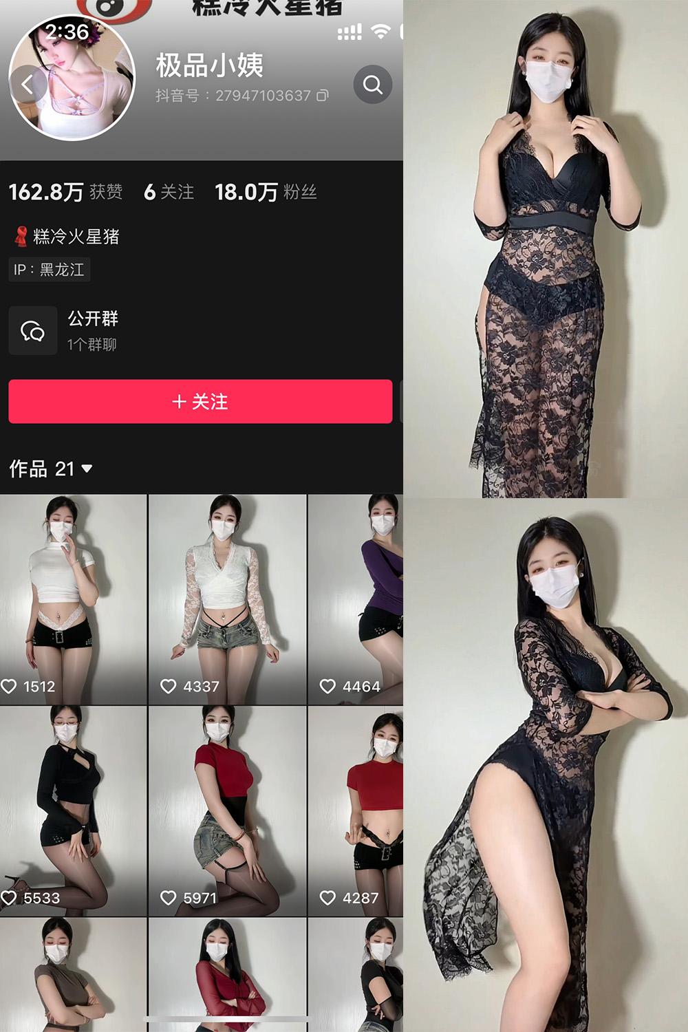 抖音 极品小姨 微密圈   NO.023期 【5V】最新至：2025.5.26-秀人网